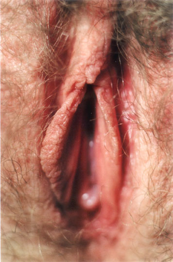 animavulve